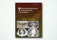 Торакоабдоминальная компьютерная томография. Образы и симптомы