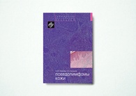 Псевдолимфомы кожи