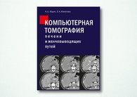 Компьютерная томография печени и желчевыводящих путей: практическое руководство